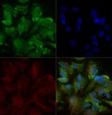 TRAIL-R2 (DR5) Antibody in Immunocytochemistry (ICC/IF)
