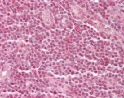 GATAD2A Antibody in Immunohistochemistry (Paraffin) (IHC (P))