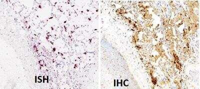 SARS Coronavirus Nucleocapsid Antibody in Immunohistochemistry (Paraffin) (IHC (P))