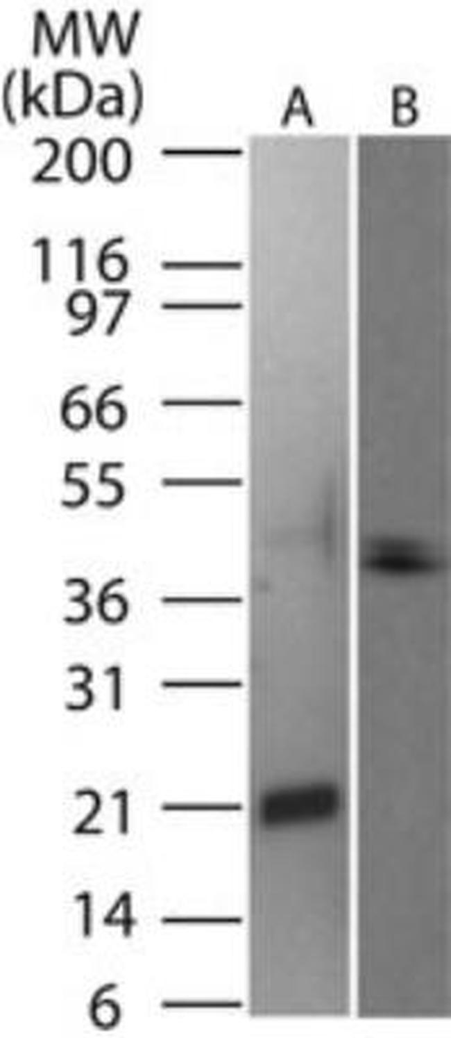 CD254 (RANK Ligand) Antibody in Western Blot (WB)