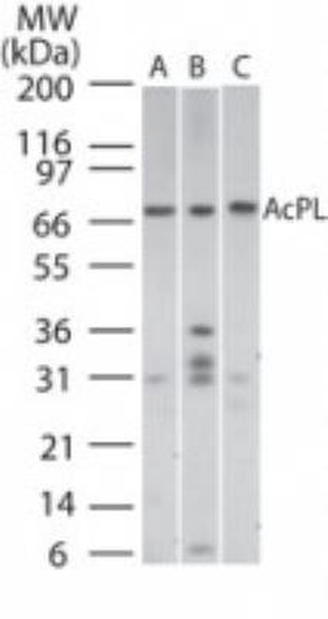 IL18RAP Antibody in Western Blot (WB)