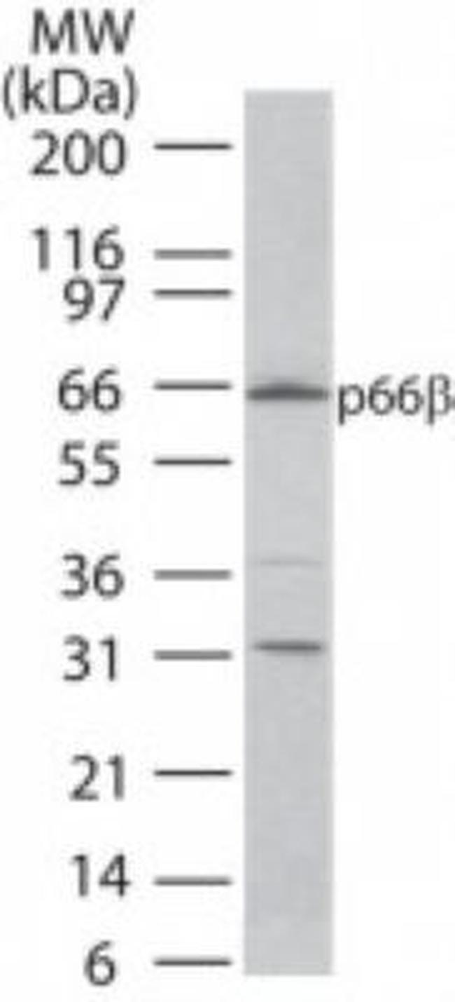 GATAD2B Antibody in Western Blot (WB)