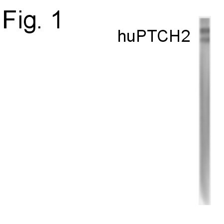 PTCH2 Antibody in Western Blot (WB)