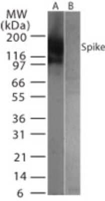 SARS Coronavirus Spike Protein Antibody in Western Blot (WB)
