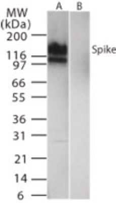 SARS Coronavirus Spike Protein Antibody in Western Blot (WB)