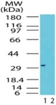 RAX Antibody in Western Blot (WB)