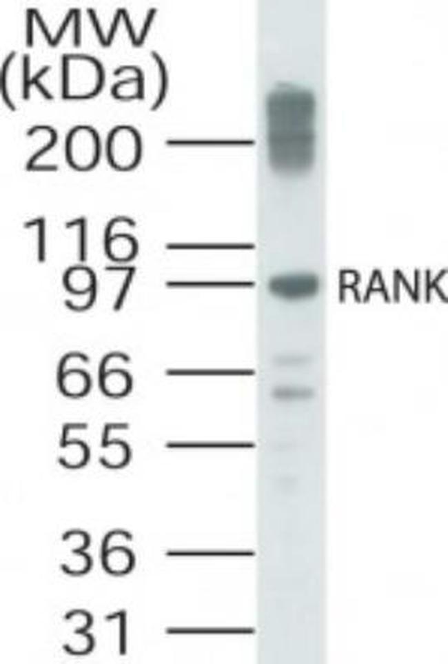 RANK Antibody in Western Blot (WB)