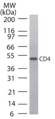 CD4 Antibody in Western Blot (WB)
