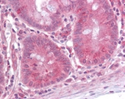 ERK1 Antibody in Immunohistochemistry (Paraffin) (IHC (P))