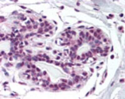 ZMYM2 Antibody in Immunohistochemistry (Paraffin) (IHC (P))