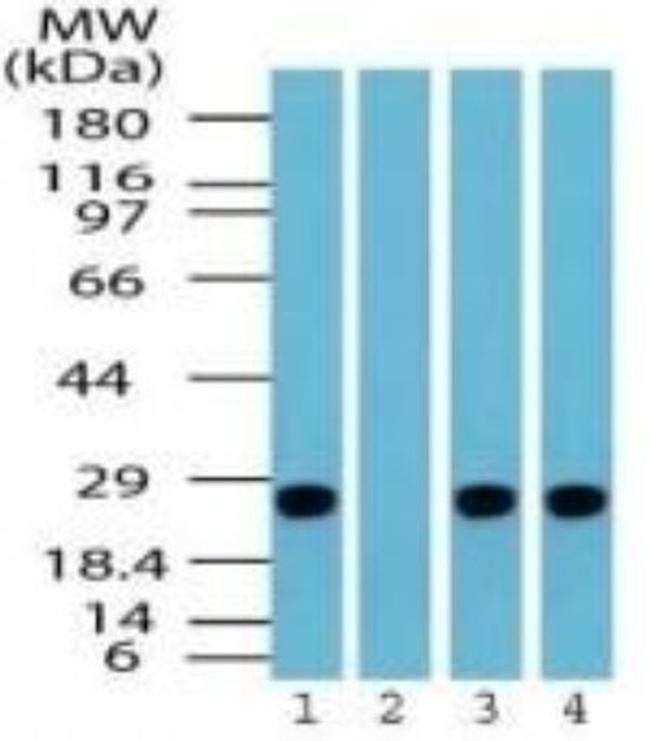 PGP9.5 Antibody in Western Blot (WB)