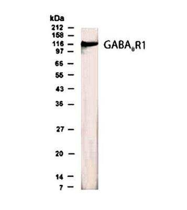 GABARAP Antibody in Western Blot (WB)
