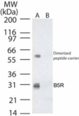 Smallpox Virus B5R Antibody in Western Blot (WB)