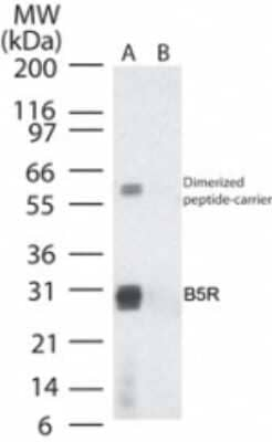 Smallpox Virus B5R Antibody in Western Blot (WB)