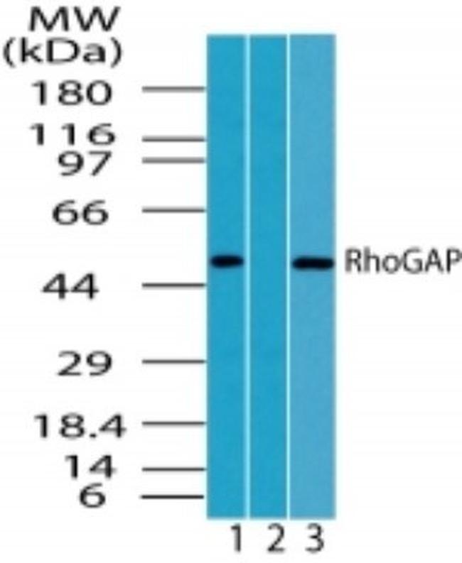 RhoGAP Antibody in Western Blot (WB)