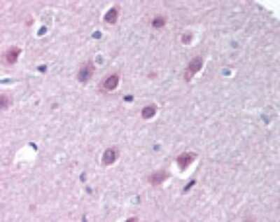 Importin 9 Antibody in Immunohistochemistry (Paraffin) (IHC (P))