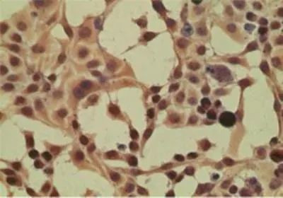 Importin 8 Antibody in Immunocytochemistry (ICC/IF)