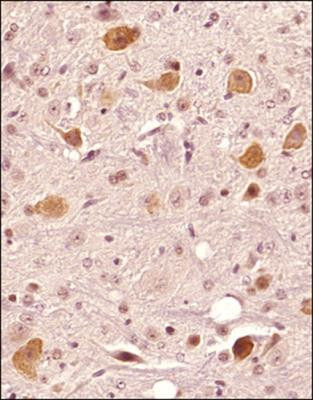 FAM3C Antibody in Immunohistochemistry (Paraffin) (IHC (P))
