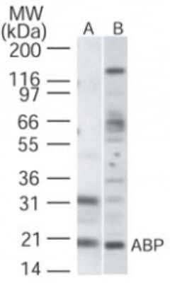 KCNIP1 Antibody in Western Blot (WB)