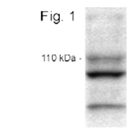 CLAC-P Antibody in Western Blot (WB)