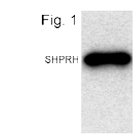 CENPI Antibody in Western Blot (WB)