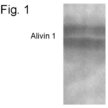Alivin 1 Antibody in Western Blot (WB)