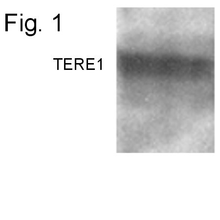 UBIAD1 Antibody in Western Blot (WB)