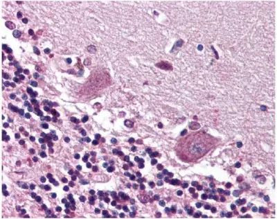 CDR2 Antibody in Immunohistochemistry (Paraffin) (IHC (P))