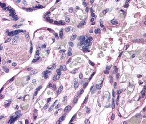 ROBO4 Antibody in Immunohistochemistry (IHC)