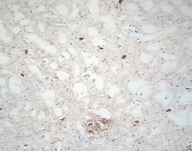 Phospho-p38 MAPK alpha (Thr180, Tyr182) Antibody in Immunohistochemistry (IHC)