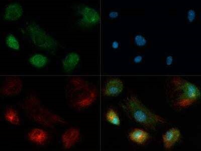 ROBO4 Antibody in Immunocytochemistry (ICC/IF)
