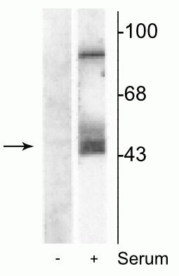 Phospho-MEK1/MEK2 (Ser218, Ser222) Antibody in Western Blot (WB)
