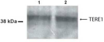 UBIAD1 Antibody in Western Blot (WB)