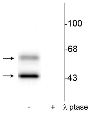Phospho-CaMKII alpha/beta (Thr286) Antibody in Western Blot (WB)