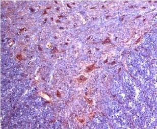 alpha-2c Adrenergic Receptor Antibody in Immunohistochemistry (IHC)