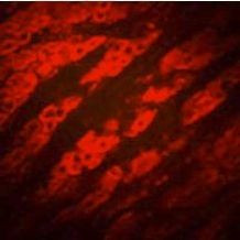 P2Y2 Antibody in Immunohistochemistry (IHC)