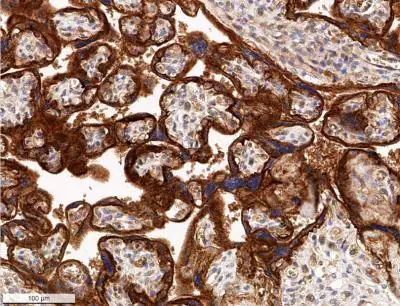 GLUT1 Antibody in Immunohistochemistry (Paraffin) (IHC (P))