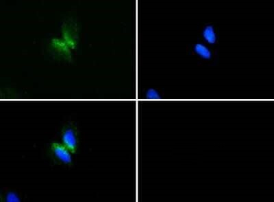 TIP47 Antibody in Immunocytochemistry (ICC/IF)