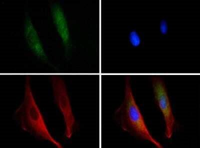 DISC1 Antibody in Immunocytochemistry (ICC/IF)