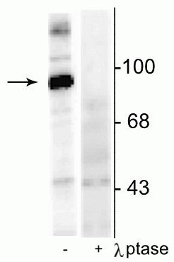 Phospho-Dynamin 1 (Ser774) Antibody in Western Blot (WB)