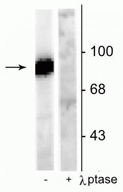Phospho-Dynamin 1 (Ser778) Antibody in Western Blot (WB)