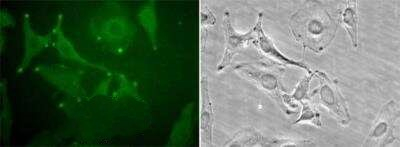 STIM1 Antibody in Immunocytochemistry (ICC/IF)