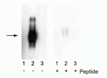 Phospho-IFNAR1 (Ser535, Ser539) Antibody in Western Blot (WB)