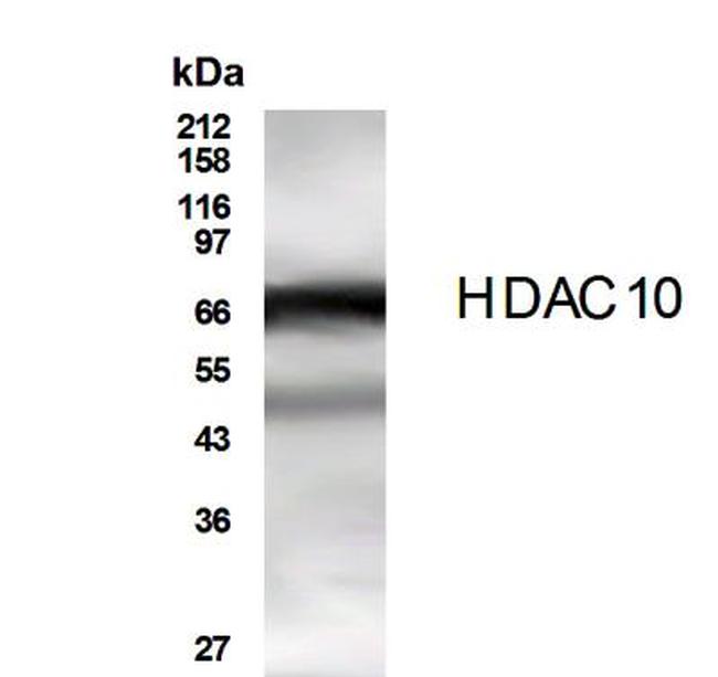 HDAC10 Antibody in Western Blot (WB)