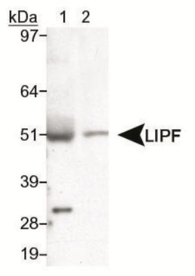LIPF Antibody in Western Blot (WB)