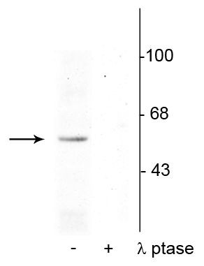 Phospho-p53 (Ser392) Antibody in Western Blot (WB)