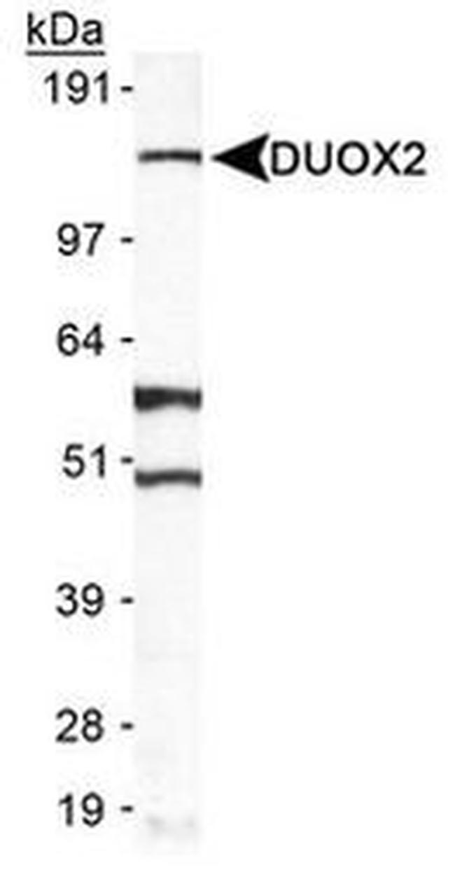 DUOX2 Antibody in Western Blot (WB)