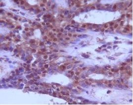 Beclin 1 Antibody in Immunohistochemistry (IHC)