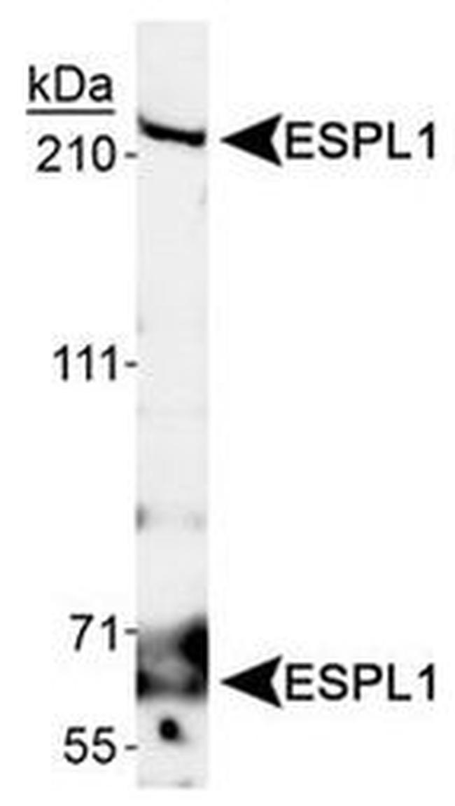 Separase Antibody in Western Blot (WB)