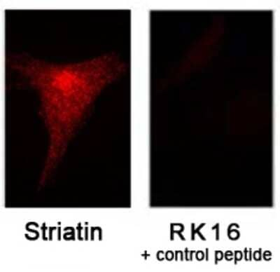 STRN Antibody in Immunocytochemistry (ICC/IF)